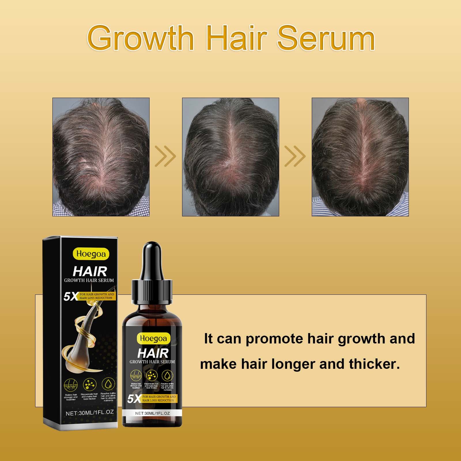 Growth Hair Serum, Prevent The Loss Of Solid Hair Nourish Thick Hair Scalp Care Dense Hair Care