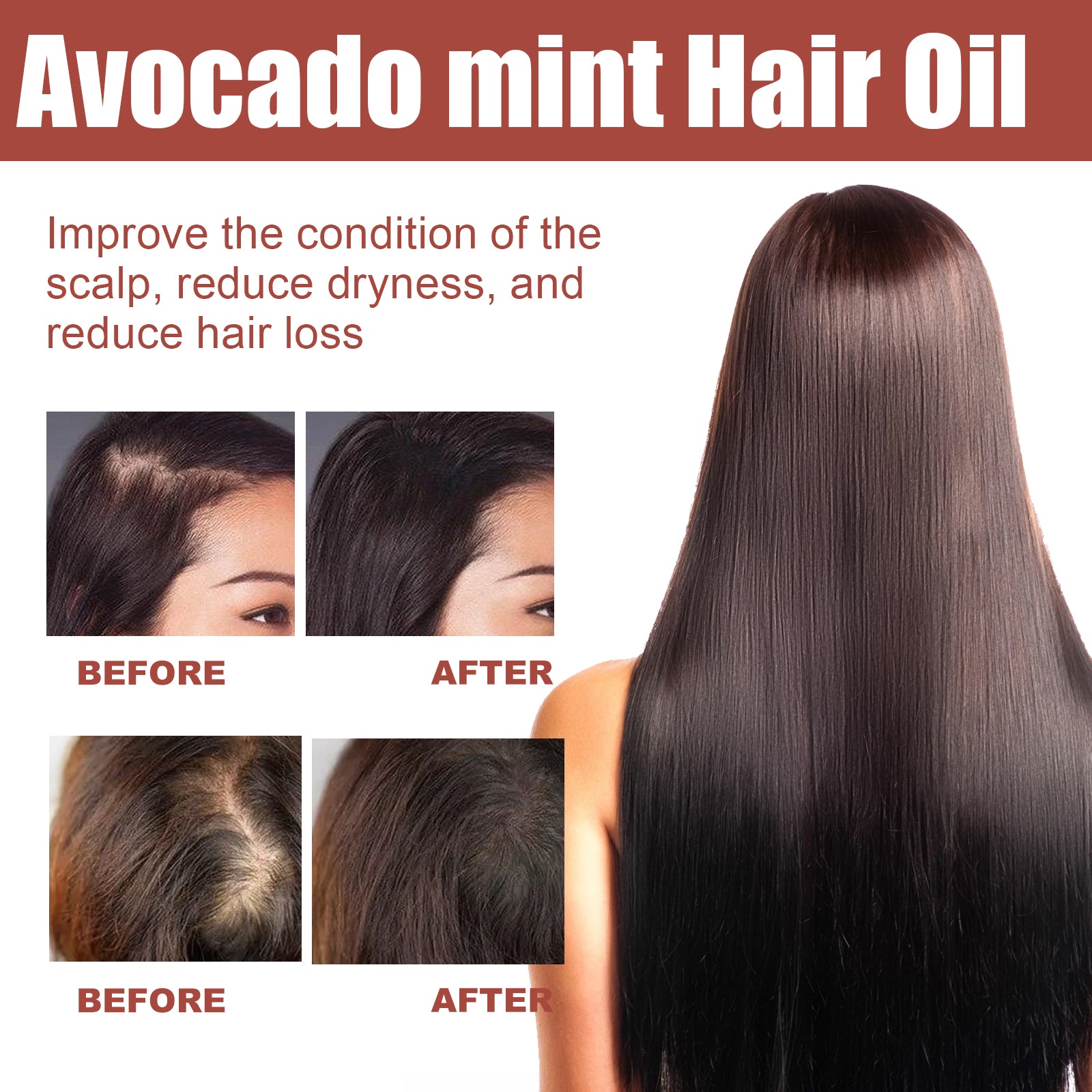 Hair Essential Oil For Dense Hair Care For Dry And Restless Hair Supple Hair Care Essential Oil For  Care